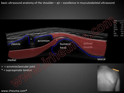 Shoulder Anatomy Ultrasound