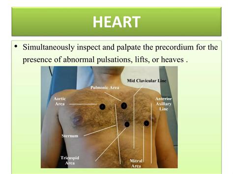 The Art And Science Of Cardiac Physical Examination With Heart Sounds Jugular And Precordial Pulsations On Cd Includes 12 Lead Ecg Interpretation 4