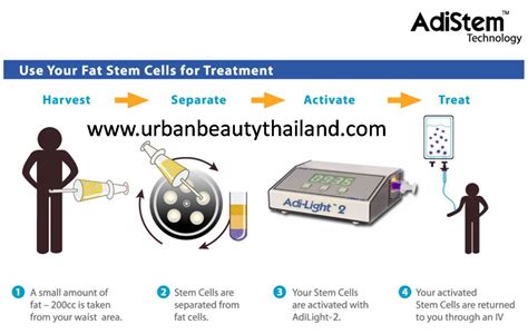 Stem Cell Vaginal Rejuvenation Thailand Urban Beauty Thailand