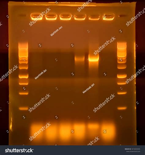 Result Agarose Gel Electrophoresis Pcr Products ภาพประกอบสต็อก