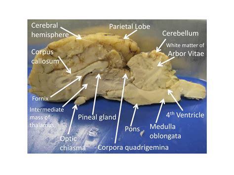 Ppt Lab 12 Sheep Brain Dissection Powerpoint Presentation Free Download Id 2162022