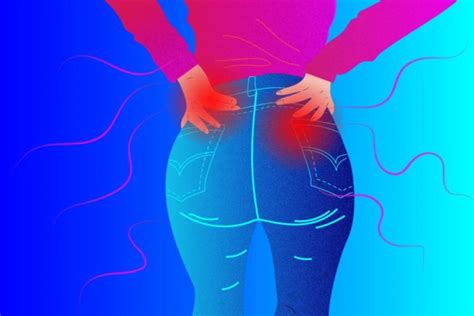 Buttock Pain: Is Arthritis Causing It? - CreakyJoints Australia