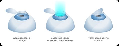 Как подготовиться к лазерной коррекции зрения в офтальмологической ...