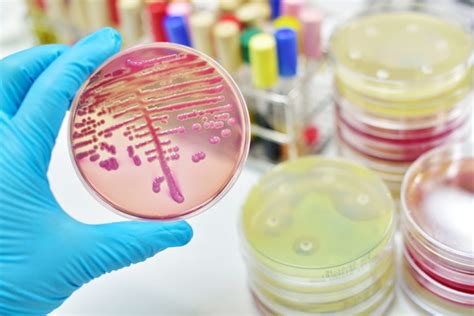 Accuracy of Rapid MALDI-TOF Bacterial Identification for Bloodstream Infections - Pulmonology ...