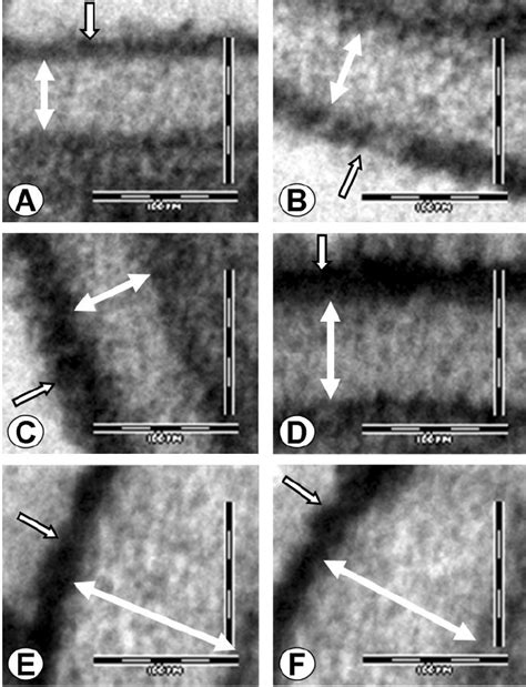 Ecm33 Is Necessary For The Normal Cell Wall Architecture Of C Albicans Download Scientific