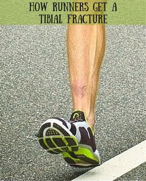 Causes Of Stress Fractures Of The Tibia In Heel Strike Runners