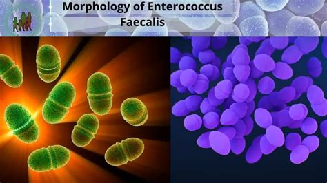 Enterococcus Faecalis Gram Stain