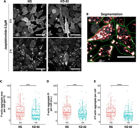 Rack Promotes Shigella Flexneri Actin Mediated Invasion Motility And