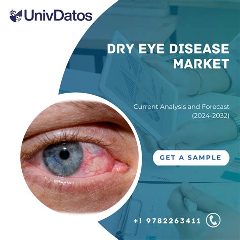 Dry Eye Disease Market Size Share Trends Report