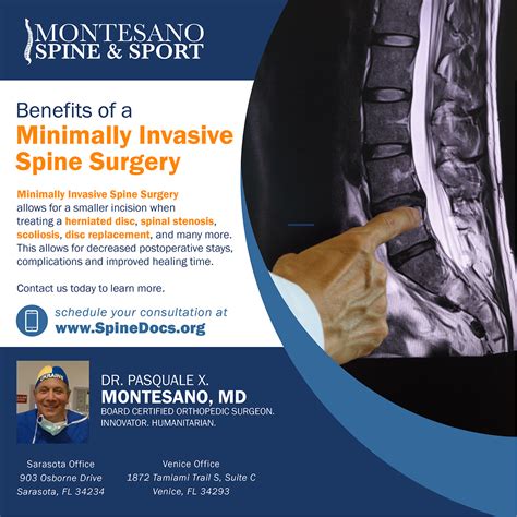 Benefits of Minimally Invasive Spine Surgery - Dr. Pasquale X. Montesano