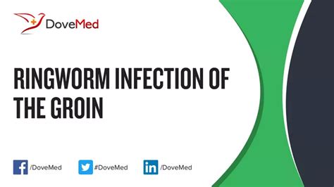 Ringworm Infection Of The Groin Dovemed