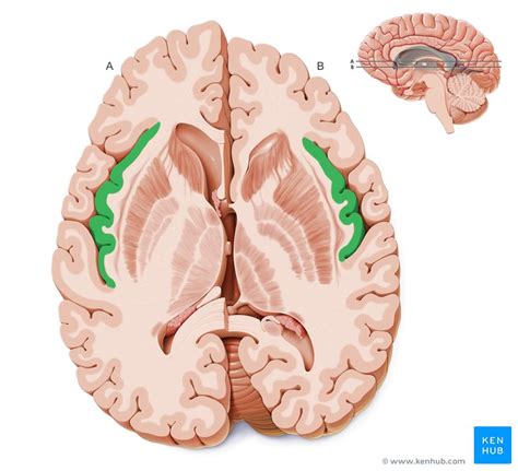 Horizontal Sections Of The Brain Anatomy Kenhub