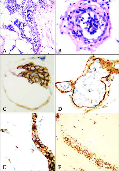 Subcutaneous Tissue Cells