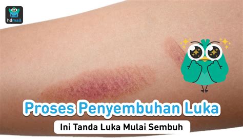 Seperti Apa Tahapan Dalam Proses Penyembuhan Luka Hdmall