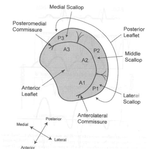 Anesthesia Principles Ii Exam I Cv Flashcards Quizlet