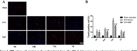 Figure 1 From L 3 N Butylphthalide Promotes Restoration After An