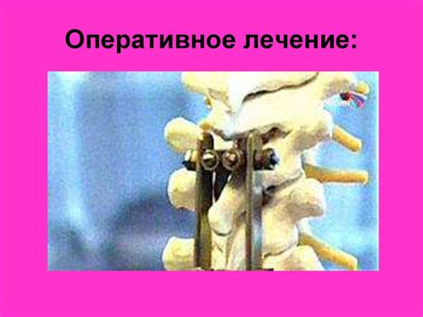 Детская ортопедия - презентация онлайн