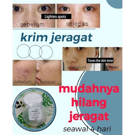 💥💥💥krim Jeragatkrim Hilangkan Jeragat Barujeragat Lamaparut Lama