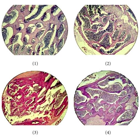 (a) The morphological picture of proximal metaphysis of femoral bone ...