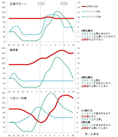 暁現象・ソモジー効果を見破れ！3：00の血糖値を測ってストレスのない眠りを確保。 糖尿病を理解して ストレスフリーな毎日を！