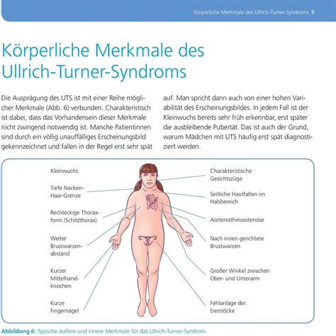 Ullrich Turner Syndrom Informationen für Eltern Betroffene und