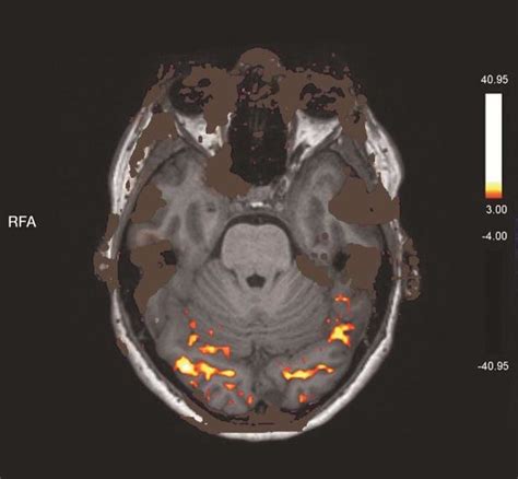 Control Group Example Fmri Scan Download Scientific Diagram