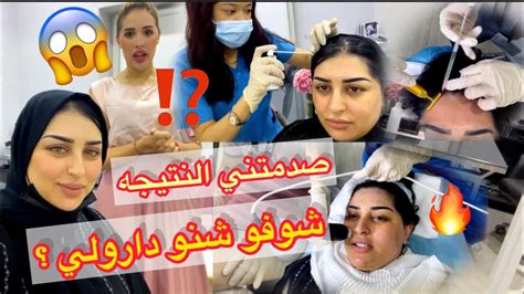 غيرت شكلي 180 درجه 😳مفاجأه لمتتبيعاتي🔥اتصدموا😳 Youtube