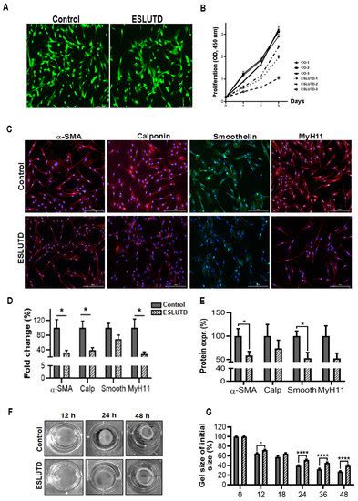 Ijms Free Full Text Myostatin Overexpression And Smad Pathway In