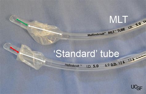 Endotracheal Tube Size Informacionpublica Svet Gob Gt