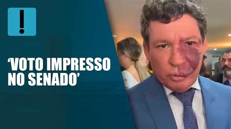 É bem capaz de eles pedirem voto impresso no Senado diz Reginaldo