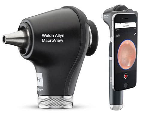 Welch Allyn MacroView Plus Otoscope Welch Allyn