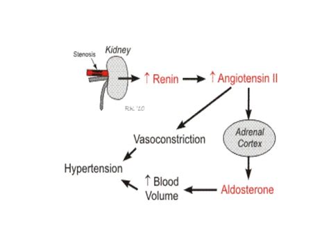 Renal Hypertension