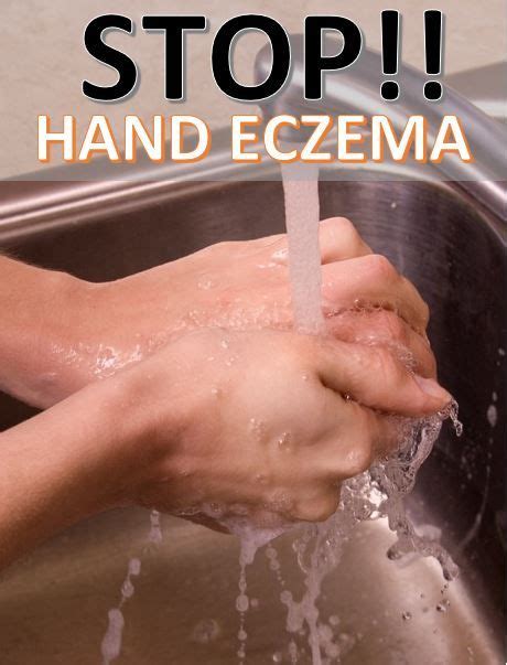 How To Use A Basin Tap Filter To Stop Hand Eczema Artofit