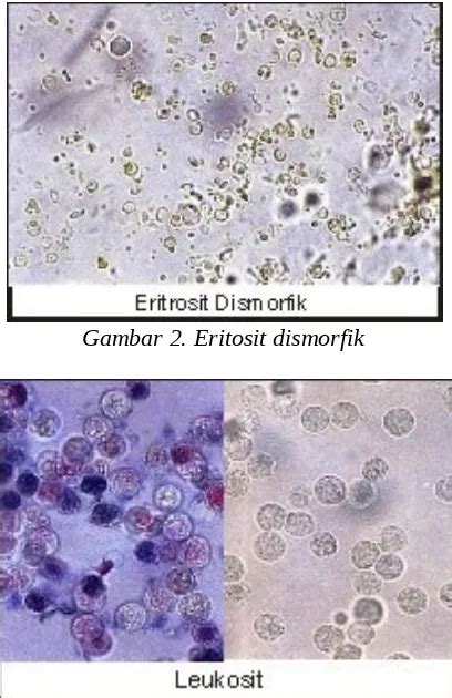 Detail Gambar Sedimen Urin Koleksi Nomer 5