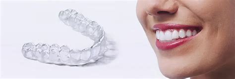 Appareil Dentaire Invisible Invisalign Orthodontie Linguale