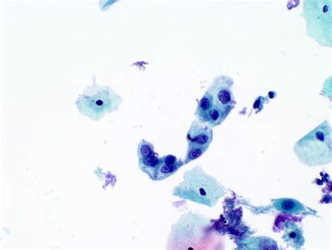 Cervical Cytology