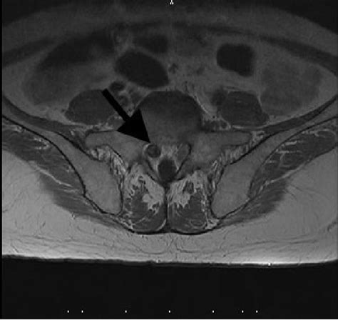 Figure 2 From A Case Of A 49 Year Old Woman With Igg4 Anti