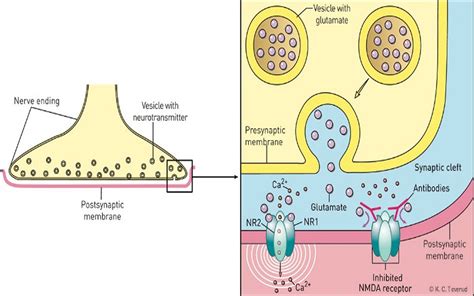 Anti Nmdar Encephalitis Brain Inflammation Symptoms And Treatments