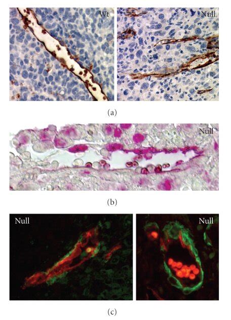 A Aquaporin 1 Immunostaining Of Endothelial Cells And Blood Vessels