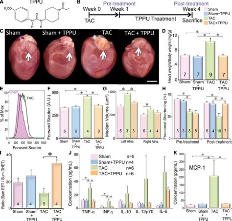 Molecular Mechanisms And New Treatment Paradigm For Atrial Fibrillation