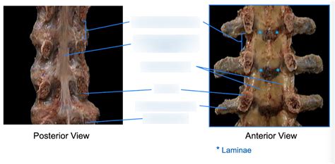 Vertebral Joints And Ligaments Posterior And Anterior View Diagram