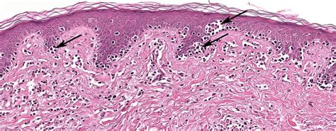 Skin Pathology Laboratory