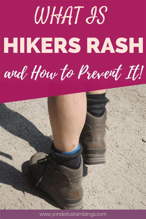 Hikers Rash: What Is It, and How to Prevent It