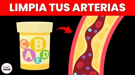 Este Es La Mejor Vitamina Para Limpiar Tus Arterias De Forma Natural