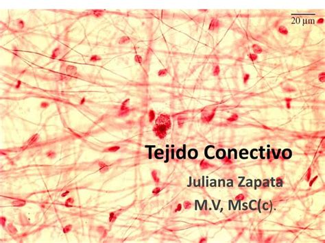 Tejidos Conectivos Ppt