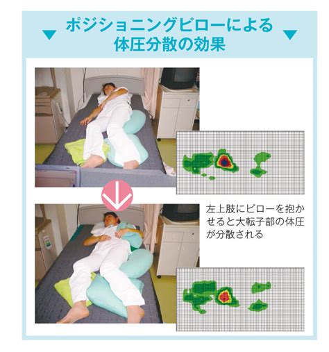 最高 エンゼル 通気ビーズパッド ベルト付 Lサイズ 1612 ポジショニング 体圧分散 体位保持 褥瘡 リスク 軽減 拘縮 日本 大阪