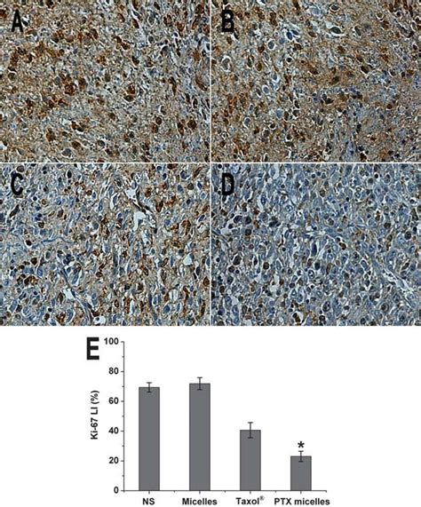 Ki 67 Immunohistochemical Staining Of Tumors Representative Ki 67