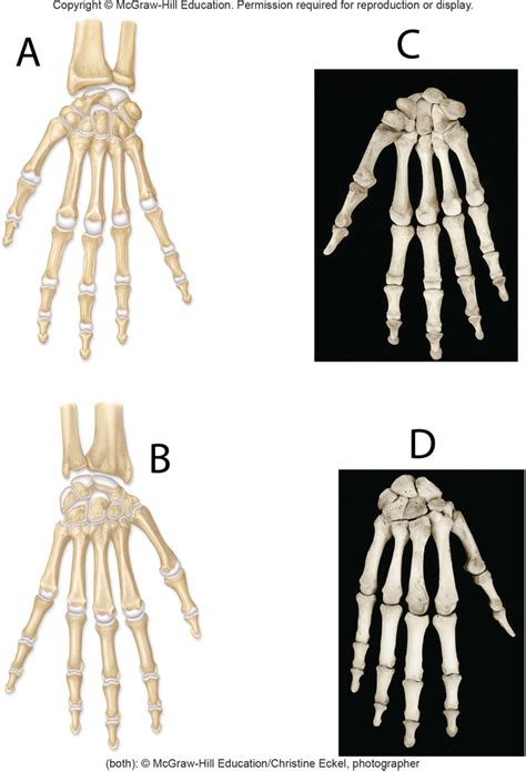 Hand Bones Anatomy Structure And Diagram | Sexiz Pix