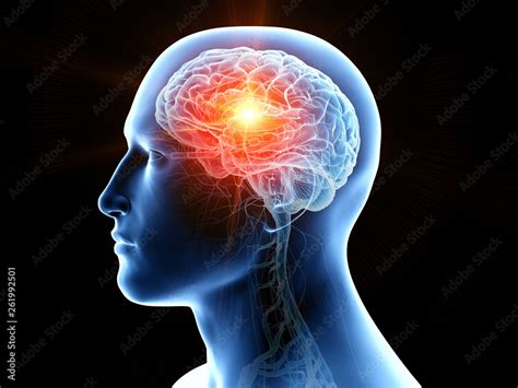 3d Rendered Medically Accurate Illustration Of Human Brain Cancer Stock Illustration Adobe Stock