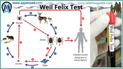 Thyrotropin Test Purpose Procedure Result And More Lab Tests Guide